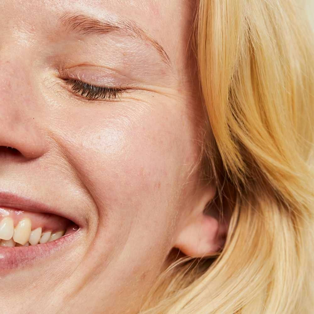 A Simple Guide To Understanding Facial Redness