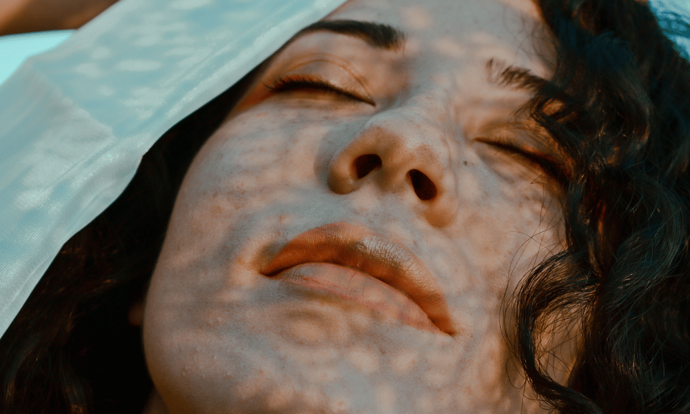 How to improve skin texture: causes and what works